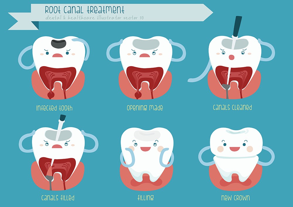 Traumatic Dental Injuries: What You Need to Know