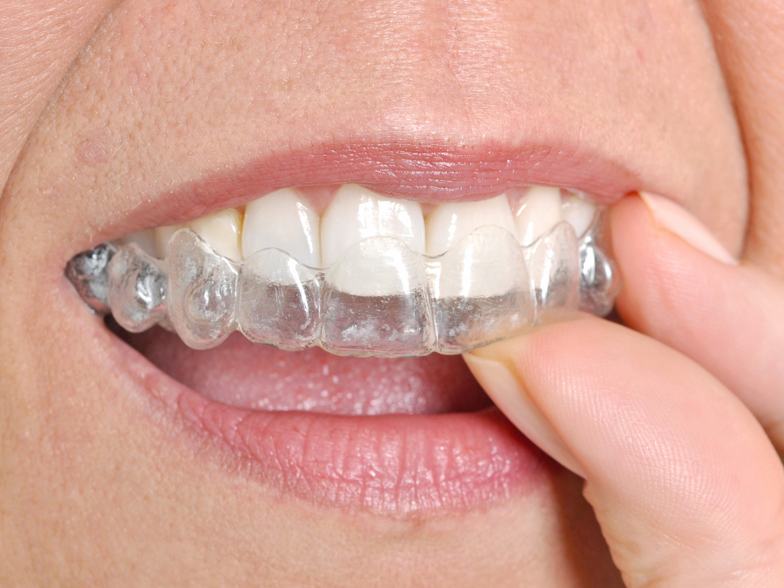 Should I sleep with my Invisalign in?