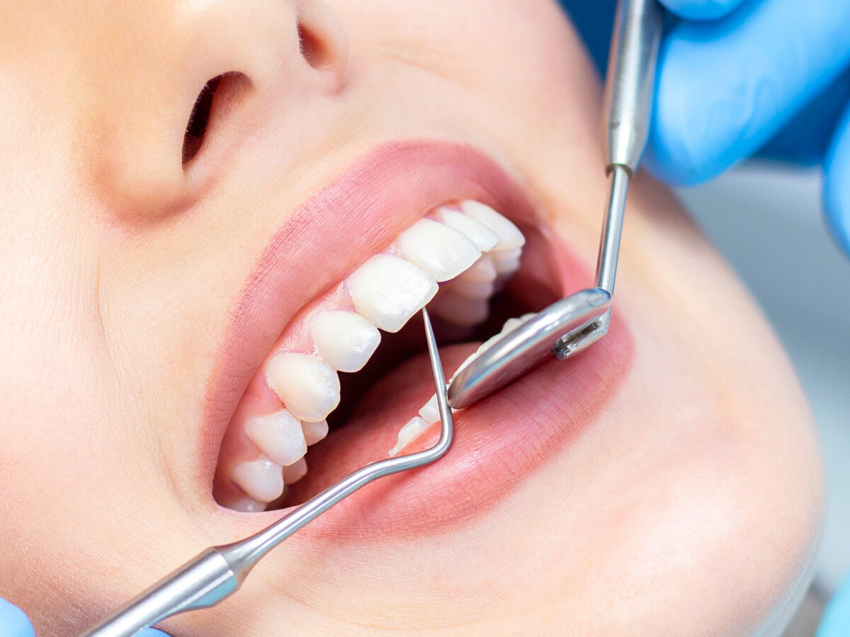How Do You Know If Your Gums Are Strong Enough For Dental Implants?