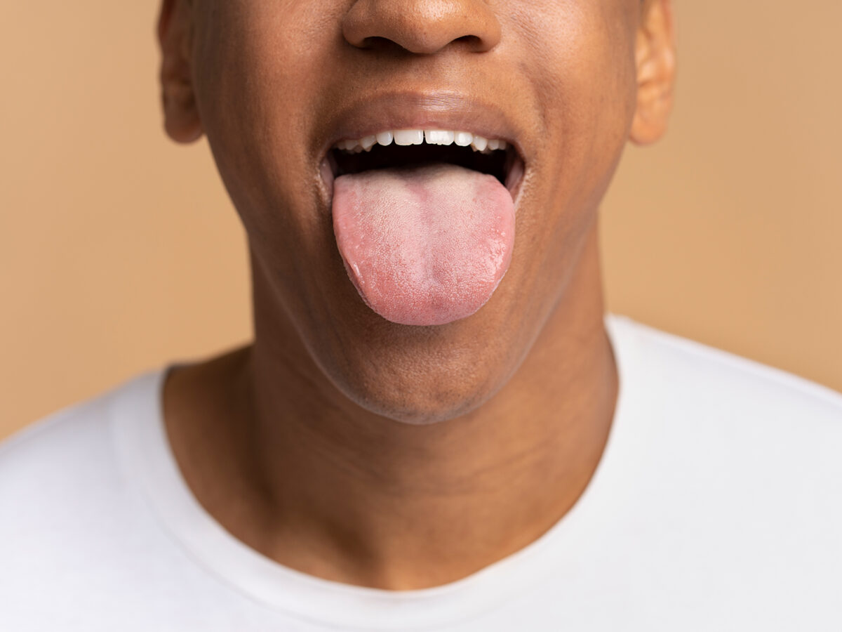 What Causes a Tingling Tongue?