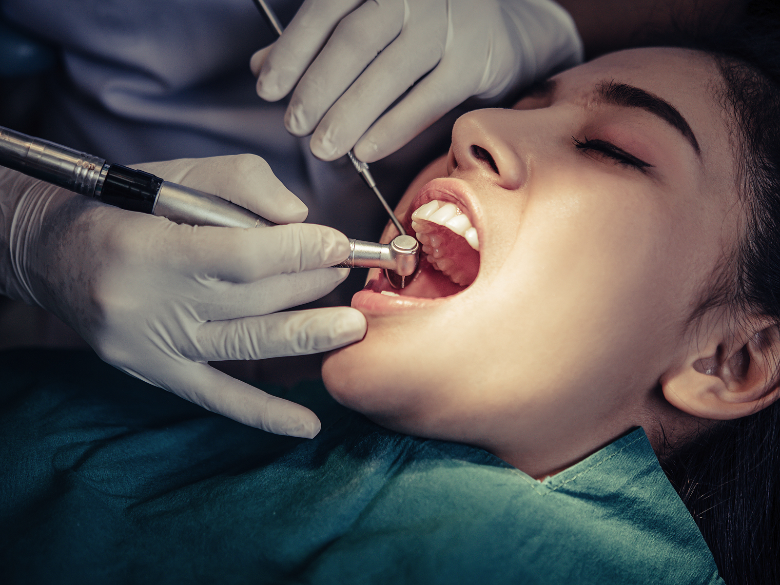How To Pick The Right Type Of Dental Fillings?