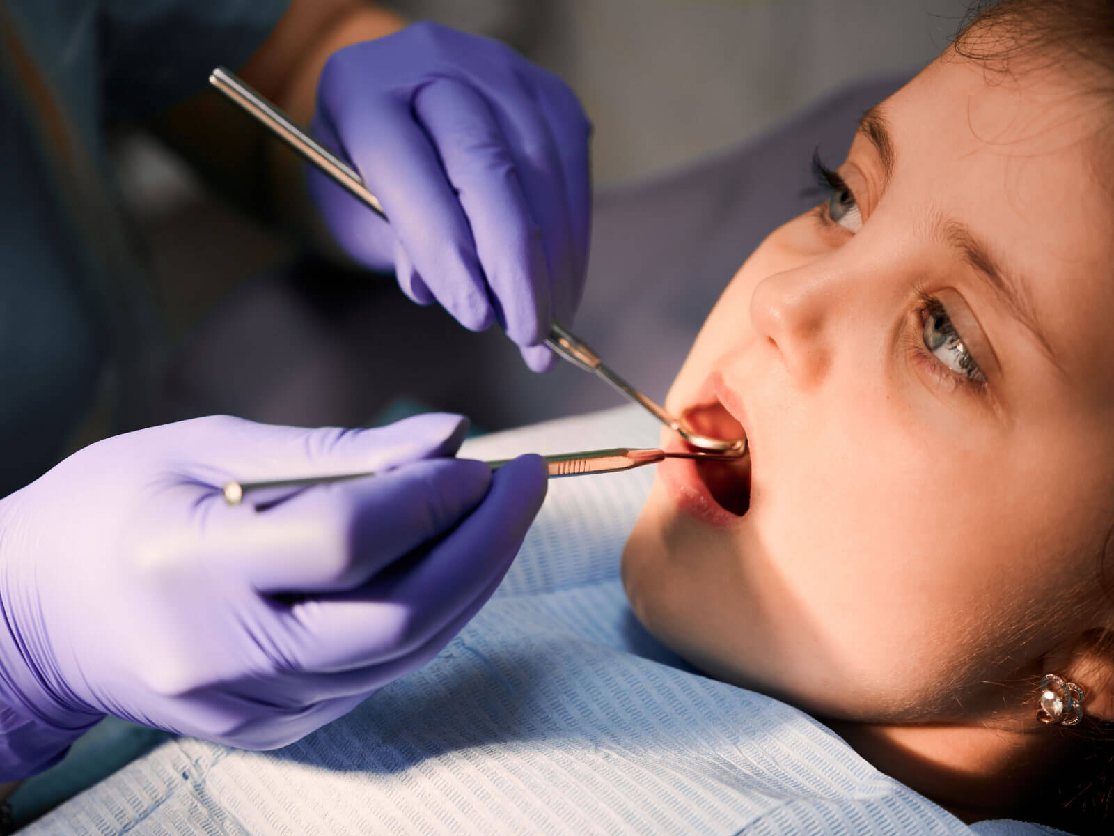 What Are Dental Sealants for Kids?