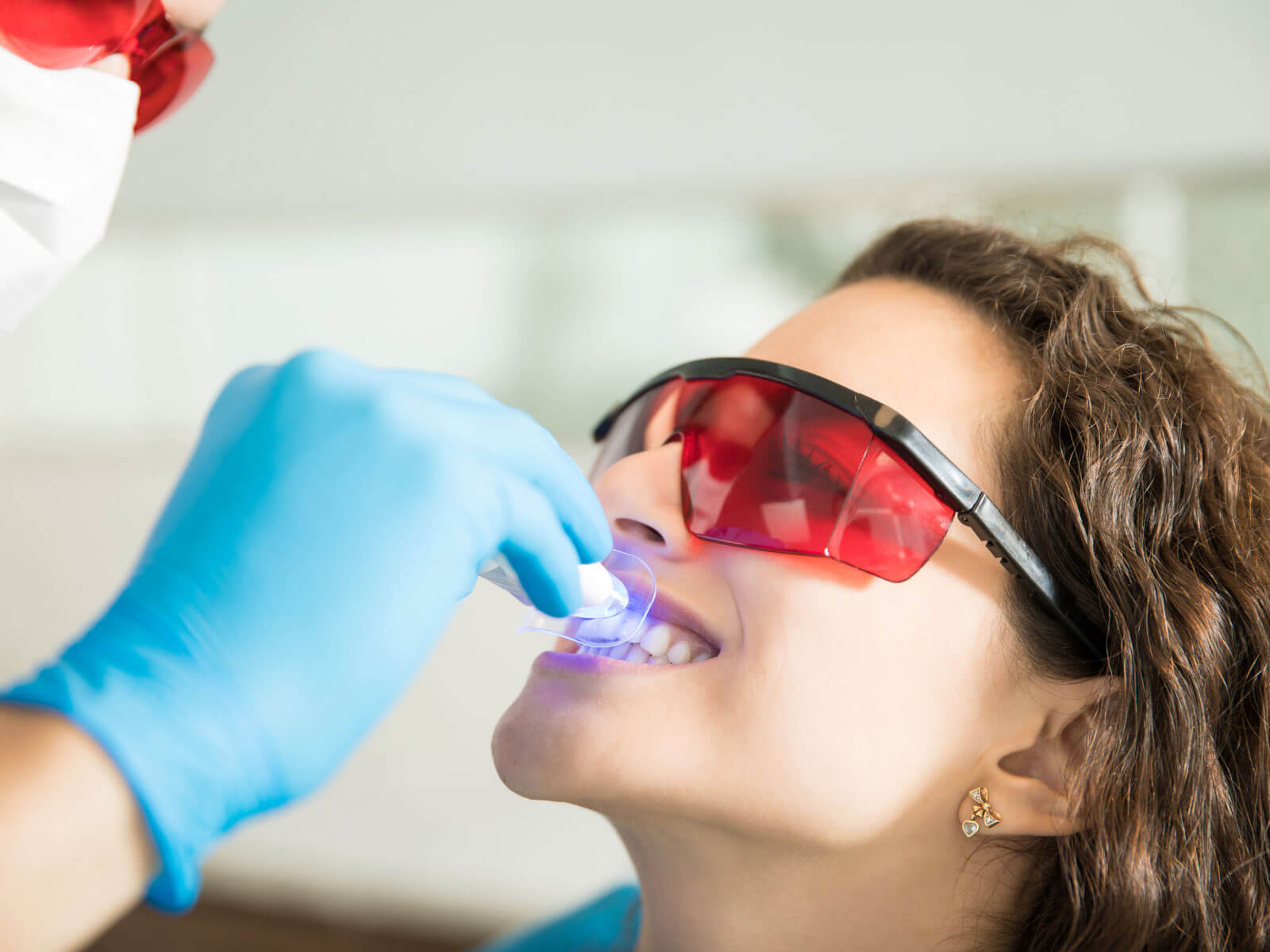 Teeth Whitening Cost: What Affects the Price?